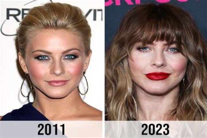 Julianne Hough Plastic Surgery Before and After
